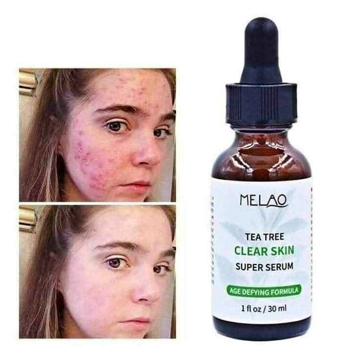 MELAO 5% B3 Niacinamide Serum | Brightening & Skin Tone Repair Face Serum | 1 oz / 30 ml