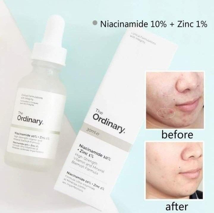 The Ordinary Niacinamide 10% + Zinc 1% High-Strength Vitamin and Blemish Formula - 30ml