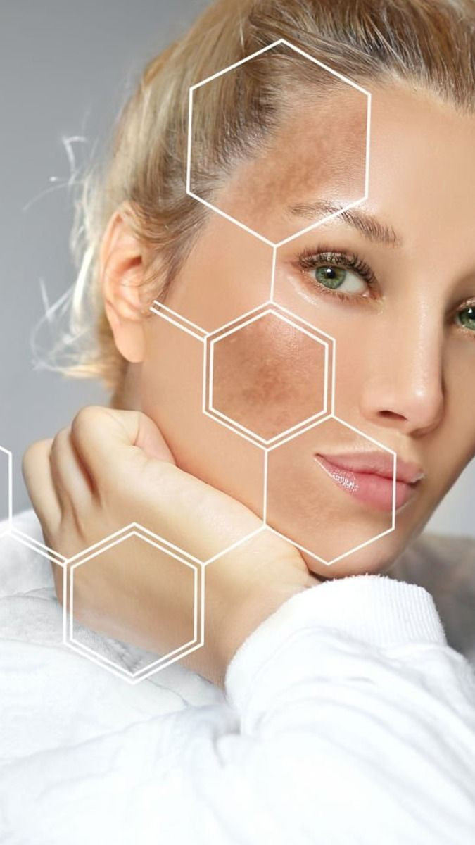 Anti-Melasma Night Cream-20ml