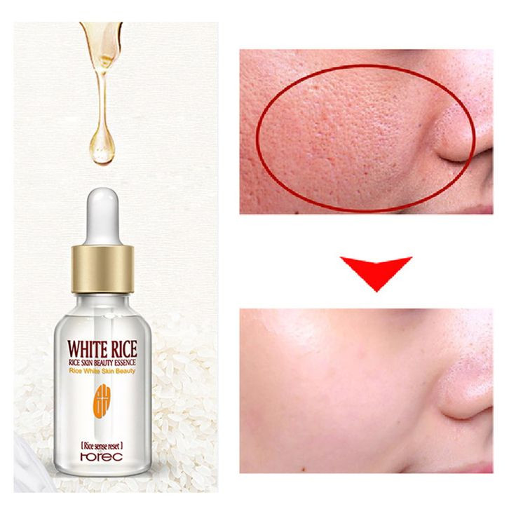 WHITE RICE RICE-SKIN BEAUTY ESSENCE - ত্বককে উজ্জ্বল ও মসৃণ করার সিরাম