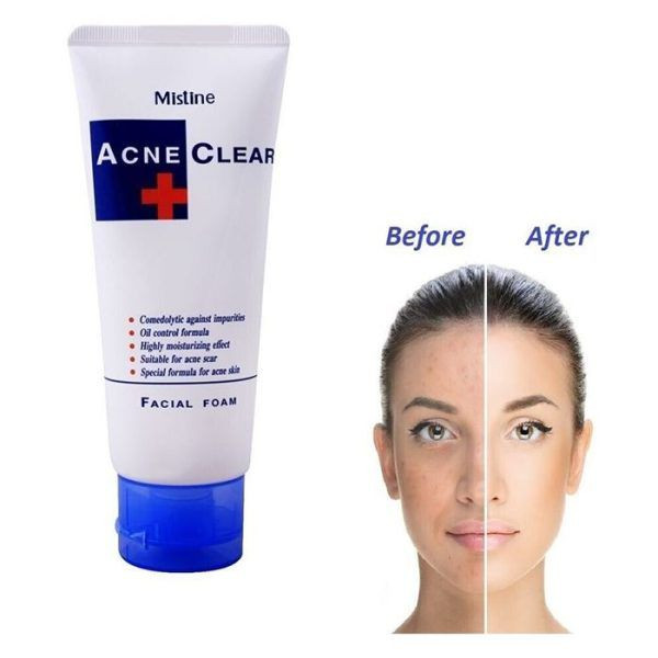 Acne Clear Facewash-85g