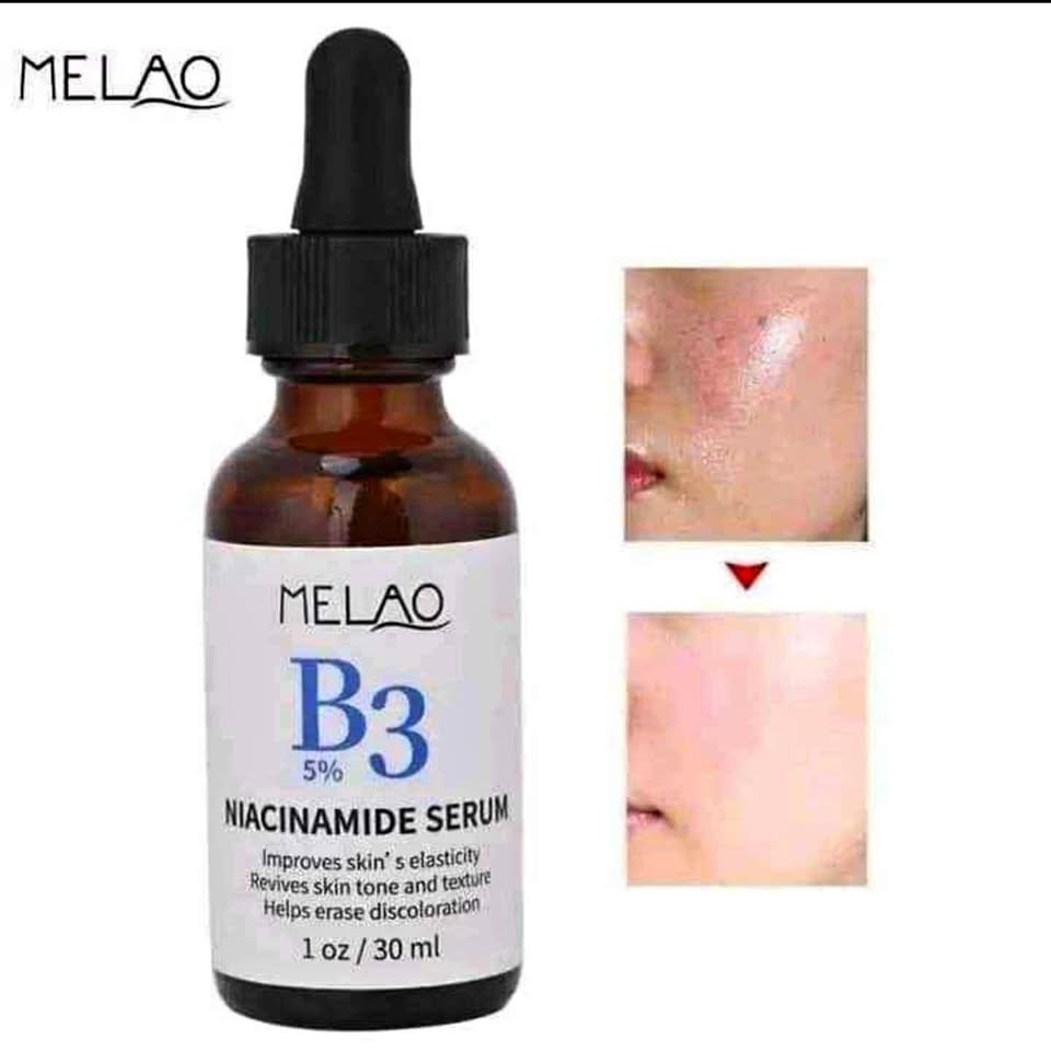 MELAO 5% B3 Niacinamide Serum | Brightening & Skin Tone Repair Face Serum | 1 oz / 30 ml